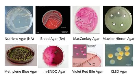 tsi e coli|e.coli culture characteristics.